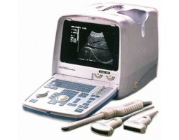 Ультразвуковой сканер HS-2000